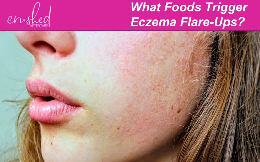 Eczema Flare-Ups - Crushed Vegan Aftercare