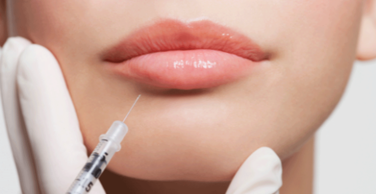 002 Lip Injection Model Close up_1200
