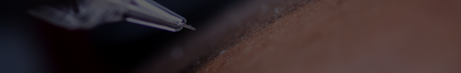 SMP banner